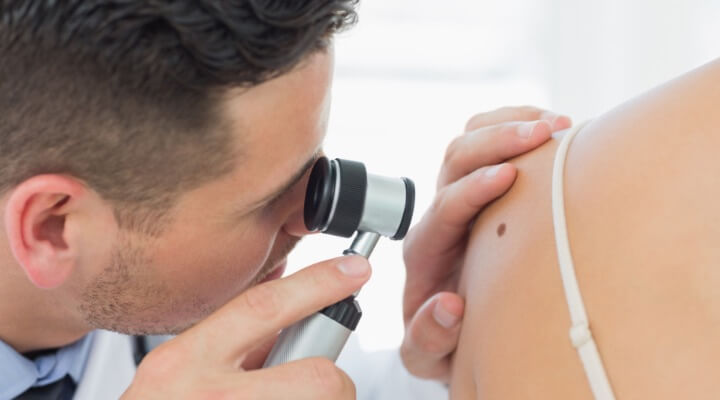 dermatologist inspecting mole on back