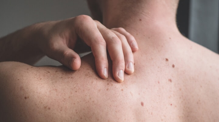Man touching skin on back
